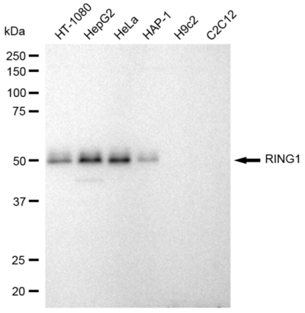 KD-Validated Anti RING1 Antibody, clone 23GB955, Rabbit Monoclonal clone 23GB955, recombinant rabbit monoclonal, expressed in HEK293 cells