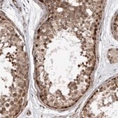 Anti-DUSP22 antibody produced in rabbit Prestige Antibodies&#174; Powered by Atlas Antibodies, affinity isolated antibody, buffered aqueous glycerol solution