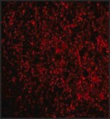 Anti-TMP21 (ab1) antibody produced in rabbit affinity isolated antibody, buffered aqueous solution