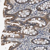 Anti-TWF1 antibody produced in rabbit Prestige Antibodies&#174; Powered by Atlas Antibodies, affinity isolated antibody, buffered aqueous glycerol solution