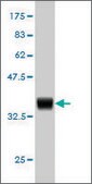 Monoclonal Anti-HOXD11 antibody produced in mouse clone 8C7, purified immunoglobulin, buffered aqueous solution
