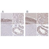 Anti-SIN3A antibody produced in rabbit Prestige Antibodies® Powered by Atlas Antibodies, affinity isolated antibody, buffered aqueous glycerol solution