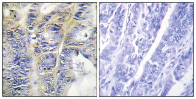 抗胶原蛋白IV &#945;5 兔抗 affinity isolated antibody