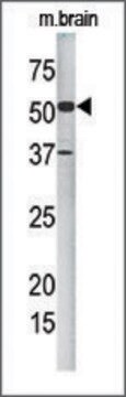 Anti-FLJ20433 (N-term) antibody produced in rabbit IgG fraction of antiserum, buffered aqueous solution