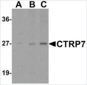 Anti-CTRP7 (ab2) antibody produced in rabbit affinity isolated antibody, buffered aqueous solution