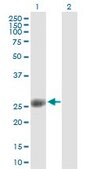 Anti-ORC6L antibody produced in mouse IgG fraction of antiserum, buffered aqueous solution