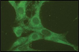 Anti-Rab7 antibody produced in rabbit affinity isolated antibody, buffered aqueous solution