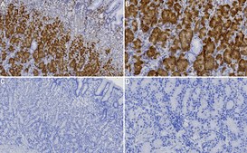Anti-Arylsulfatase A Antibody, clone 2C19 ZooMAb® Rabbit Monoclonal recombinant, expressed in HEK 293 cells