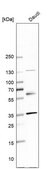 Anti-SLAMF6 antibody produced in rabbit Prestige Antibodies&#174; Powered by Atlas Antibodies, affinity isolated antibody, buffered aqueous glycerol solution