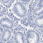 Anti-UBQLN3 antibody produced in rabbit Prestige Antibodies® Powered by Atlas Antibodies, affinity isolated antibody, buffered aqueous glycerol solution