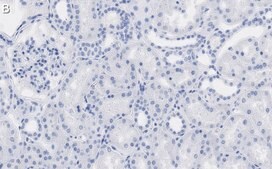 Anti-QPRTase Antibody, clone 1G22 ZooMAb® Rabbit Monoclonal recombinant, expressed in HEK 293 cells
