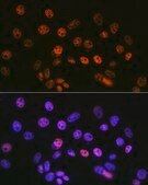 Anti-mSin3A Antibody, clone 8V5B6, Rabbit Monoclonal