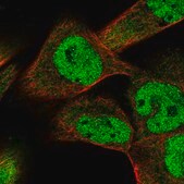 Anti-SMAD9 antibody produced in rabbit Prestige Antibodies&#174; Powered by Atlas Antibodies, affinity isolated antibody, buffered aqueous glycerol solution