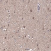 Anti-ABL2 antibody produced in rabbit Prestige Antibodies® Powered by Atlas Antibodies, affinity isolated antibody