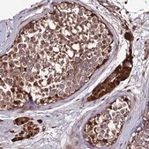 Anti-DDX19A antibody produced in rabbit Prestige Antibodies&#174; Powered by Atlas Antibodies, affinity isolated antibody, buffered aqueous glycerol solution