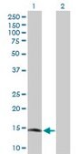 Anti-RARRES2 antibody produced in rabbit IgG fraction of antiserum, buffered aqueous solution