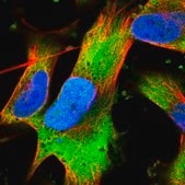 Anti-VWDE antibody produced in rabbit Prestige Antibodies&#174; Powered by Atlas Antibodies, affinity isolated antibody, buffered aqueous glycerol solution