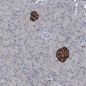 Anti-TINAG antibody produced in rabbit Prestige Antibodies&#174; Powered by Atlas Antibodies, affinity isolated antibody, buffered aqueous glycerol solution