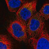 Anti-GATB antibody produced in rabbit Prestige Antibodies&#174; Powered by Atlas Antibodies, affinity isolated antibody, buffered aqueous glycerol solution
