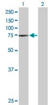 Anti-STRA6 antibody produced in rabbit purified immunoglobulin, buffered aqueous solution