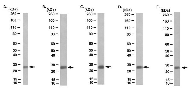 Anti-P53DINP1 Antibody, clone F8 from rat