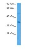 Anti-SCAMP1 antibody produced in rabbit affinity isolated antibody