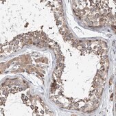 Anti-CEP85L antibody produced in rabbit Prestige Antibodies® Powered by Atlas Antibodies, affinity isolated antibody, buffered aqueous glycerol solution, ab2
