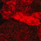 SKOV3 Cells GFP-HER2 RFP-EGFR