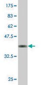 Monoclonal Anti-CPA2 antibody produced in mouse clone 2E11, purified immunoglobulin, buffered aqueous solution