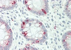 Anti-STYK1 antibody produced in rabbit affinity isolated antibody