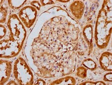 Anti-phospho-EIF2AK2 (T446) antibody, clone 2F8, Rabbit Monoclonal recombinant, expressed in HEK293F cells
