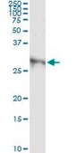 Monoclonal Anti-DKK1 antibody produced in mouse clone 2B12, purified immunoglobulin, buffered aqueous solution