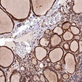 Anti-MRPS11 antibody produced in rabbit Prestige Antibodies&#174; Powered by Atlas Antibodies, affinity isolated antibody, buffered aqueous glycerol solution