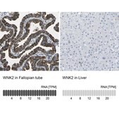 Anti-WNK2 antibody produced in rabbit Prestige Antibodies® Powered by Atlas Antibodies, affinity isolated antibody, buffered aqueous glycerol solution