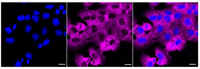 KD-Validated Anti LPP Antibody, clone 24GB05, Rabbit Monoclonal clone 24GB05, recombinant rabbit monoclonal, expressed in HEK293 cells
