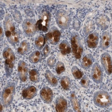Anti-CCDC126 antibody produced in rabbit Prestige Antibodies&#174; Powered by Atlas Antibodies, affinity isolated antibody, buffered aqueous glycerol solution