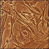 Rabbit Aortic Smooth Muscle Cells: RbAOSMC (Cryovial)