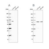 Anti-OPTN antibody produced in rabbit Ab1, Prestige Antibodies® Powered by Atlas Antibodies, affinity isolated antibody, buffered aqueous glycerol solution