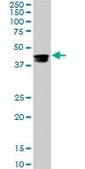 Monoclonal Anti-CMAS antibody produced in mouse clone 5A2, purified immunoglobulin, buffered aqueous solution