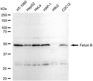 Anti Fetuin B Antibody, clone 23GB5725, Rabbit Monoclonal clone 23GB5725, recombinant rabbit monoclonal, expressed in HEK293 cells