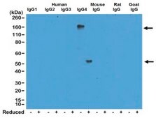 Rabbit-Anti-Human IgG4 Antibody, clone RM120 clone RM120, from rabbit