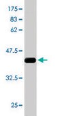 Monoclonal Anti-RPS6KA6 antibody produced in mouse clone 3E2, ascites fluid, solution