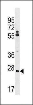 ANTI-CNPY3(N-TERMINAL) antibody produced in rabbit affinity isolated antibody, buffered aqueous solution
