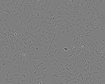 SAOS-2 Cell Line human NOTE: Both the cell line and DNA from the cell line may be available for this product. Please choose -1VL or VIAL for cells, or -DNA-5UG for DNA, 89050205, human bone, Epithelial-like