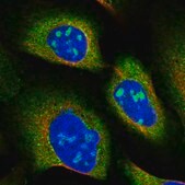 Anti-SNX15 antibody produced in rabbit Prestige Antibodies&#174; Powered by Atlas Antibodies, affinity isolated antibody, buffered aqueous glycerol solution