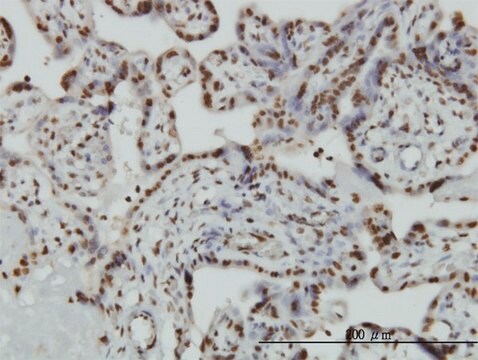 ANTI-HMGB2 antibody produced in mouse clone 3D2, purified immunoglobulin, buffered aqueous solution