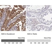 抗-ADA 兔抗 Prestige Antibodies® Powered by Atlas Antibodies, affinity isolated antibody, buffered aqueous glycerol solution