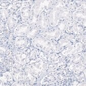 Monoclonal Anti-AGER antibody produced in mouse Prestige Antibodies® Powered by Atlas Antibodies, clone CL10591, purified antibody (Protein A)
