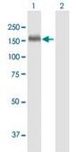 Anti-THBS1 antibody produced in mouse purified immunoglobulin, buffered aqueous solution