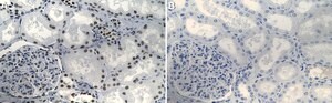 Anti-BRG1/SMARCA4 Antibody, clone 20C3.2 ZooMAb&#174; Mouse Monoclonal recombinant, expressed in HEK 293 cells